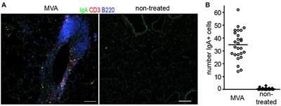 Combating COVID-19: MVA Vector Vaccines Applied to the Respiratory Tract as Promising Approach Toward Protective Immunity in the Lung